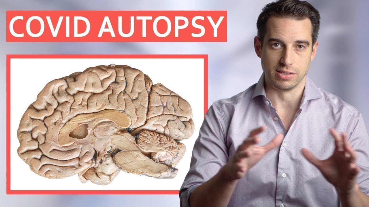 18 COVID Autopsies - This is what they found in the Brain 😱
