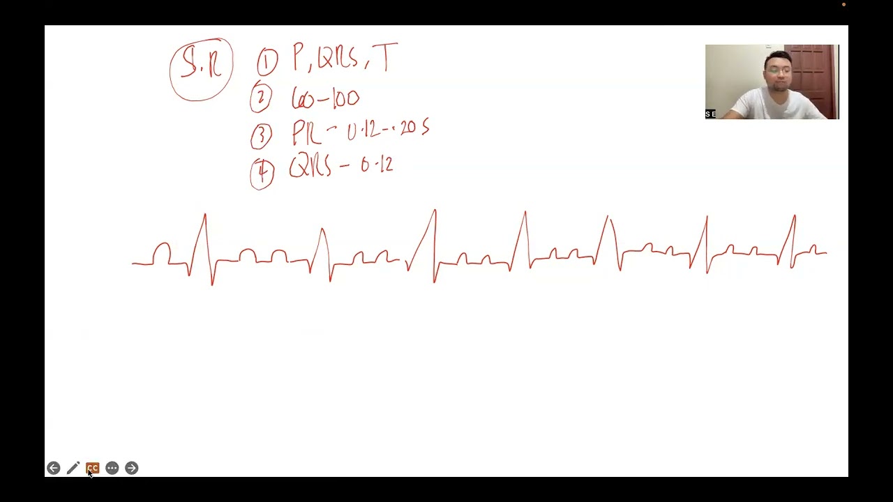 CARDIO Series: ECG (Electrocardiogram) - PART 2