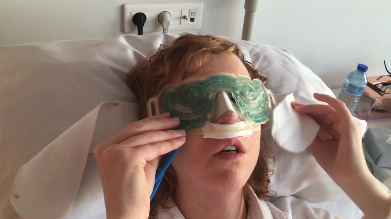 Reducing Swelling after Facial Feminization Surgery
