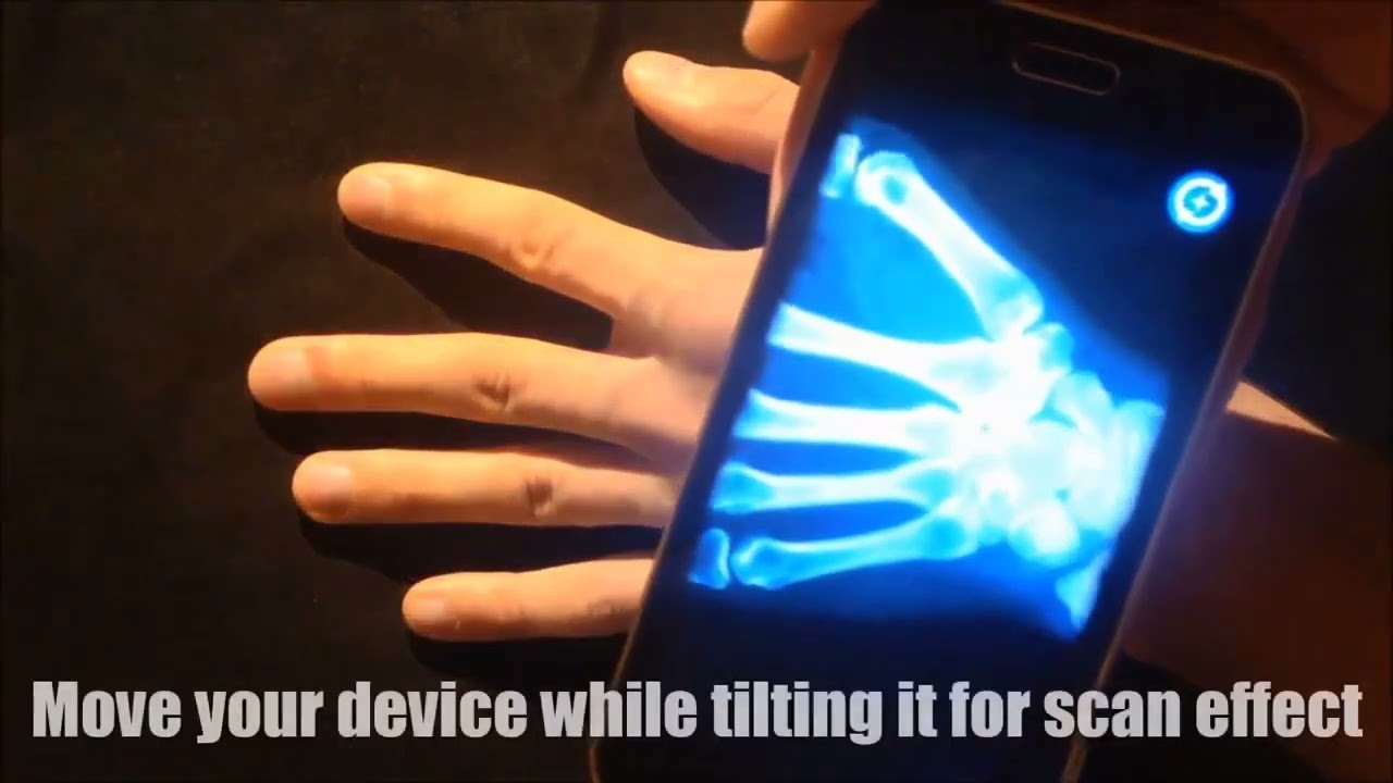 Xray Body Scanner