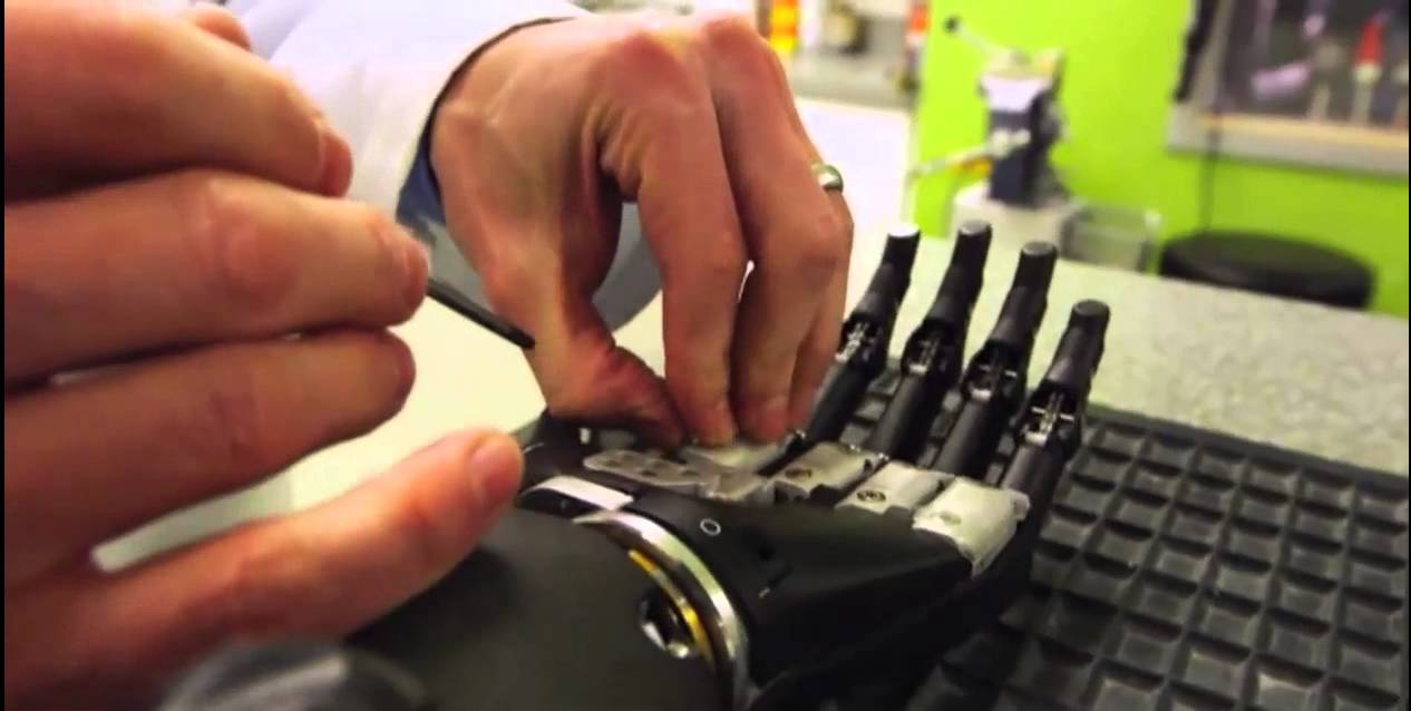 Wakeboarder Who Lost Hand Goes Bionic With 
