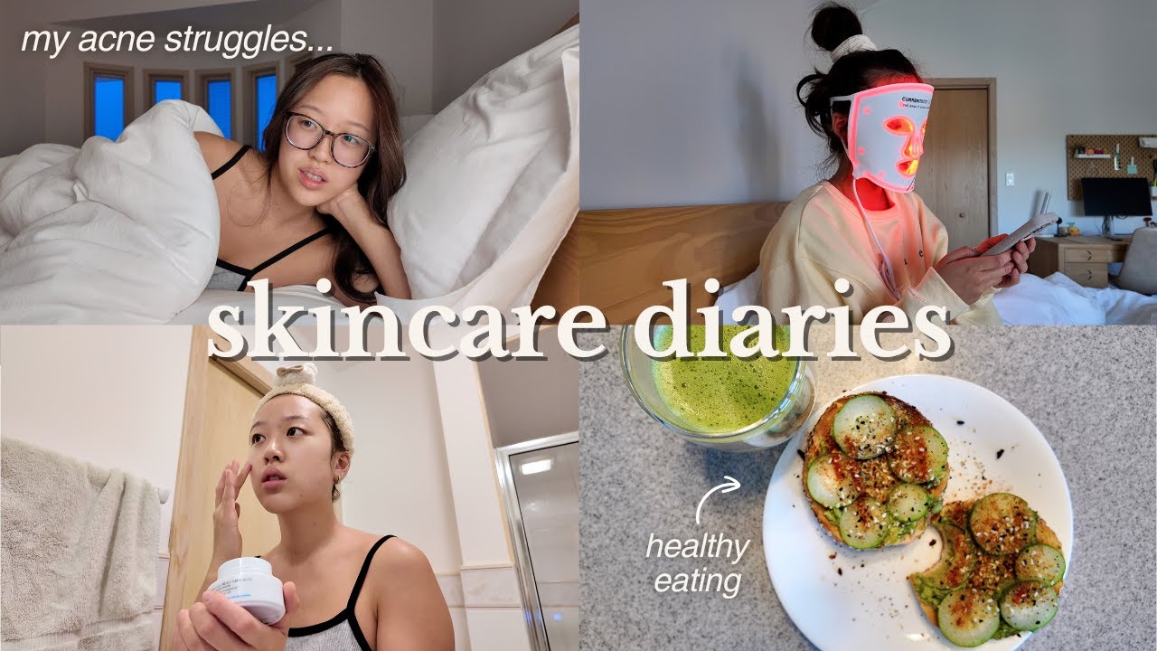 skincare diaries | my current routine, acne struggles, what i eat for clear skin