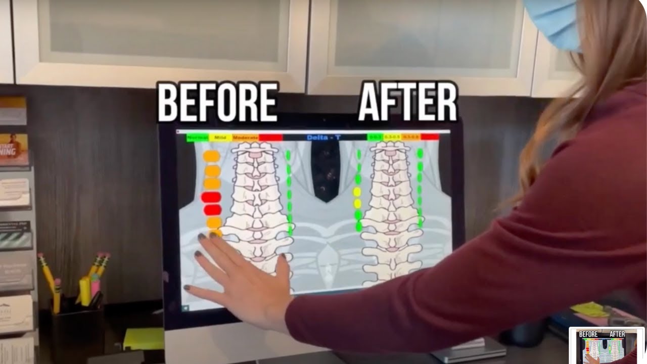 Behind The Scenes: Upper Cervical Chiropractic of Boulder Colorado - Christina Coblish, DC