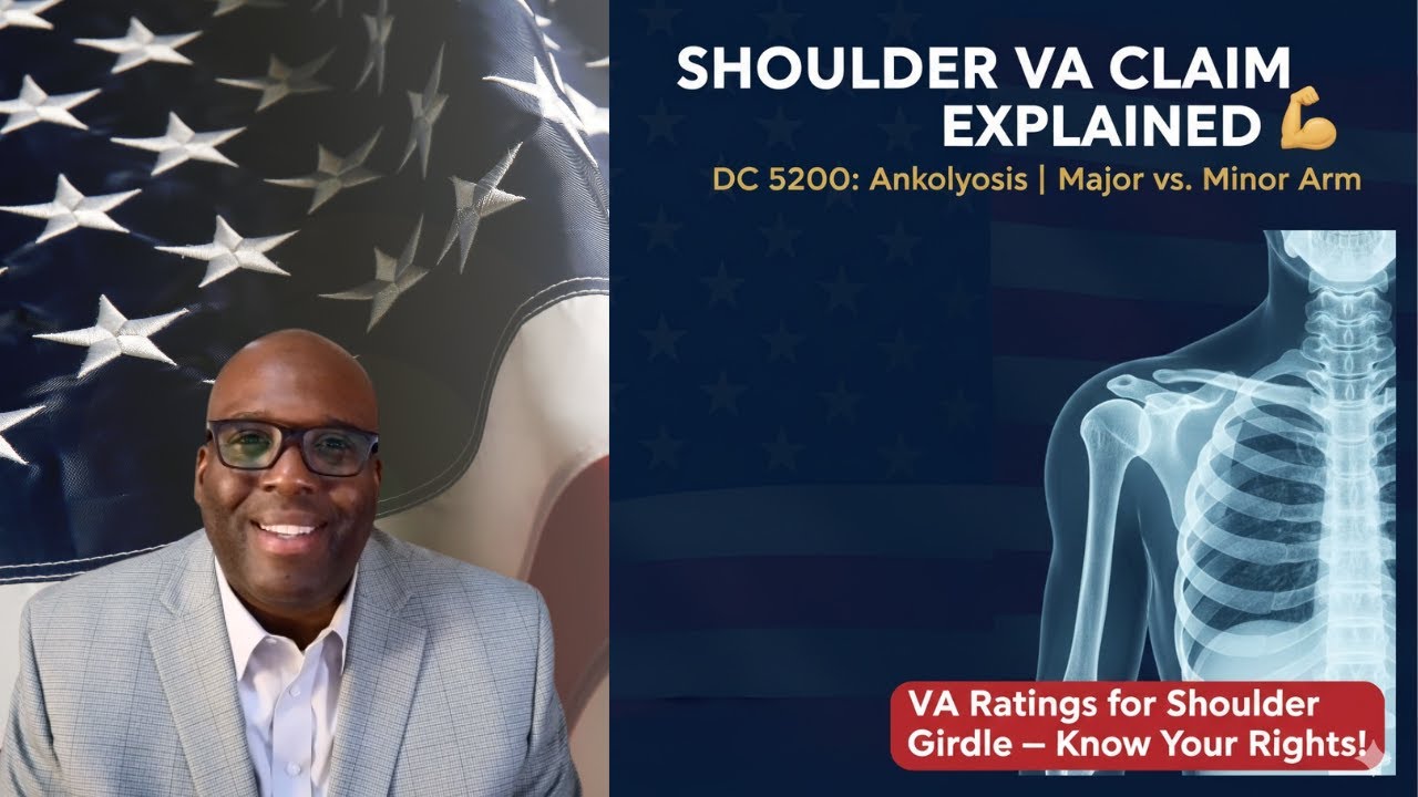 DC 5200 VA Claim Explained | Ankylosis of the Shoulder Girdle (Major vs. Minor Arm Ratings)