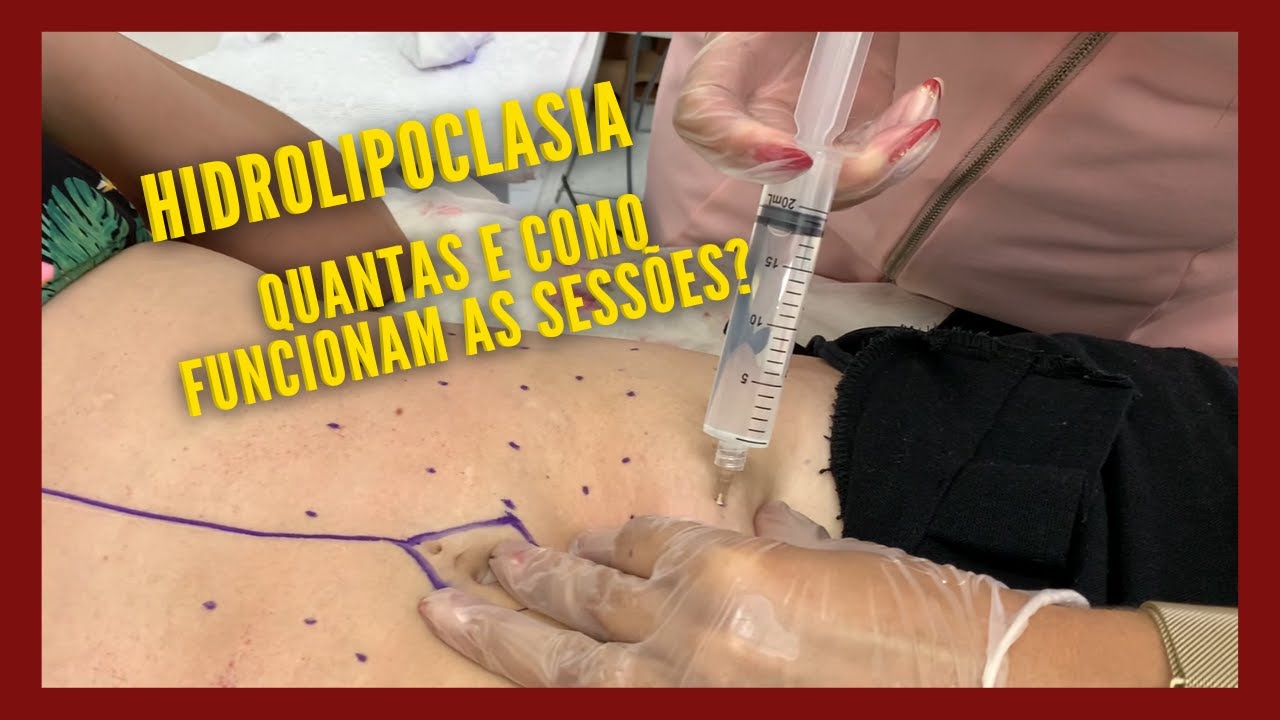 Como é feita a hidrolipoclasia?