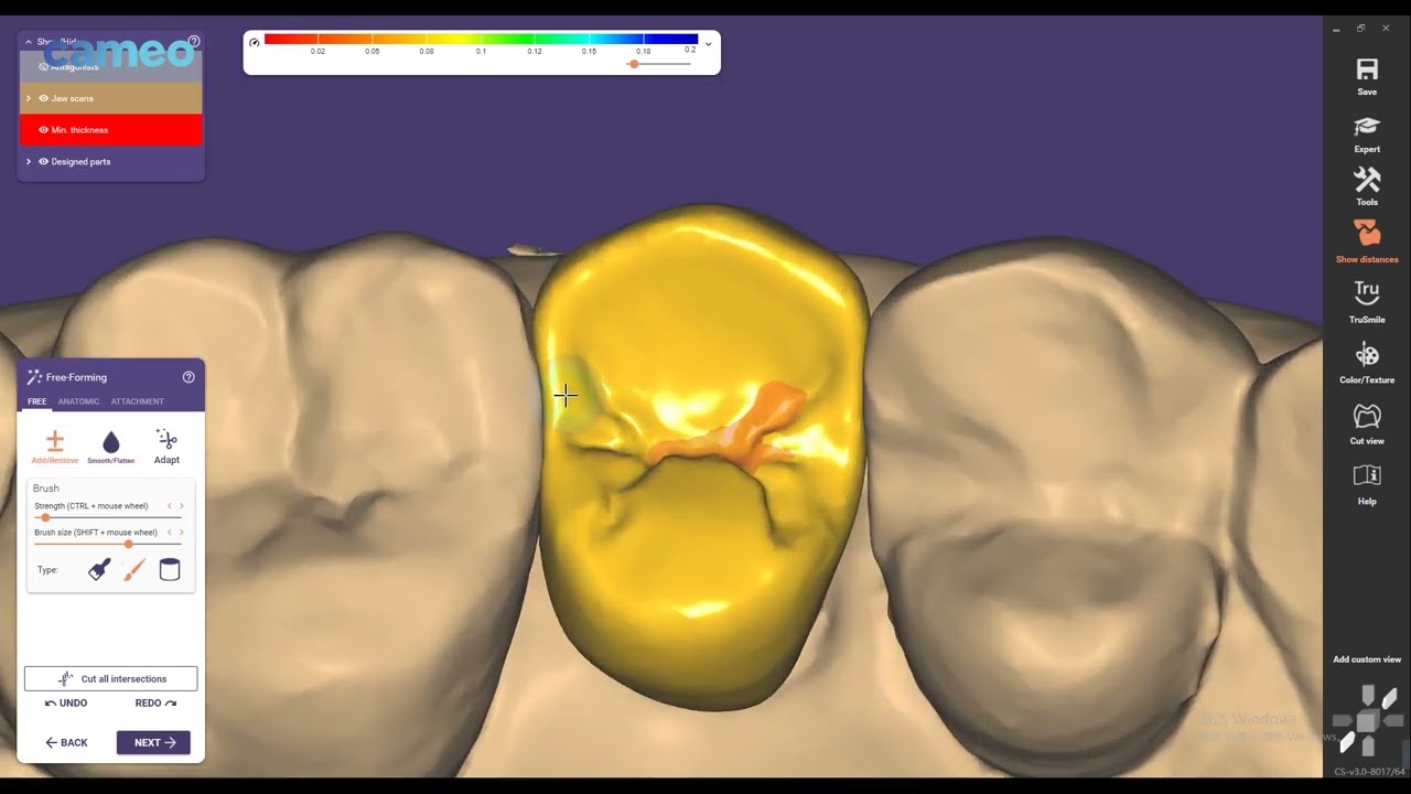 Aidite Exocad design guide: Premolar design