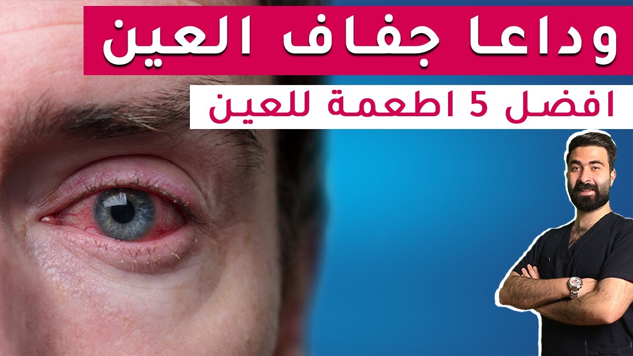 جفاف العين الاسباب والعلاج | وداعا لحرقان واحمرار العين | افضل طعام للتخلص من جفاف العين والحكة
