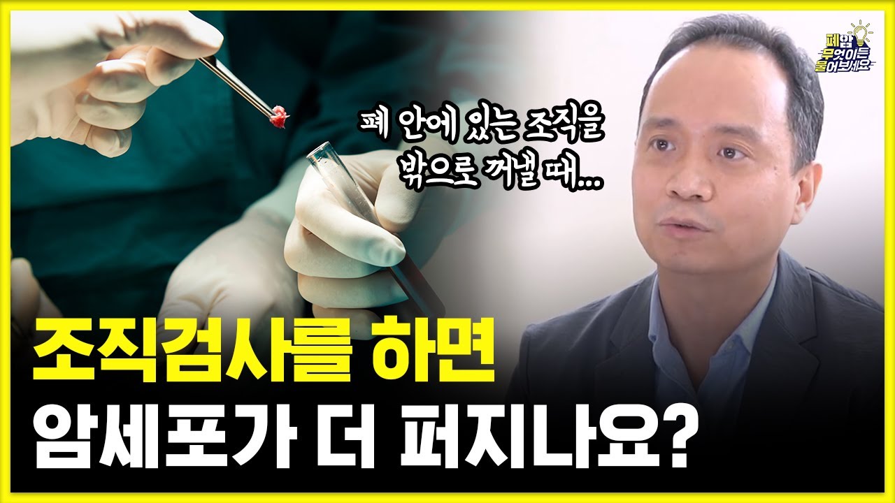 폐암 치료의 시작, 폐조직검사 어떻게 할까요? | 조직검사는 암을 전이시킬까? | 대한폐암학회