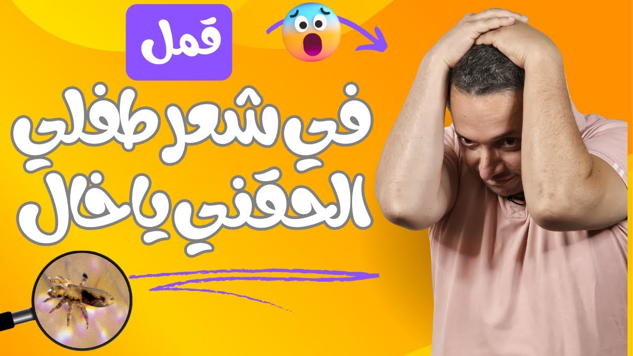 عيب اوى طفلك يكون عنده حشرات شعر وينزل المدرسه من غير ما تعالجيه
