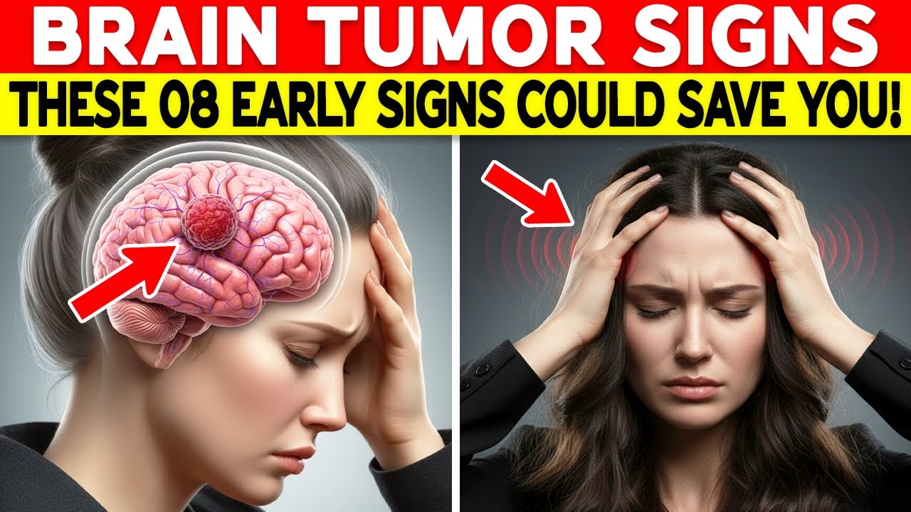 Never Miss These 8 Early Brain Tumor Signs – It Could Save You!