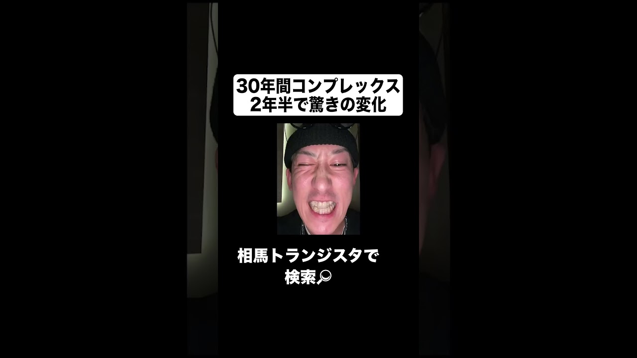 30年間コンプレックスだったガチャ歯が2年半で驚きの結果に&hellip; #相馬トランジスタ #矯正 #カルビ