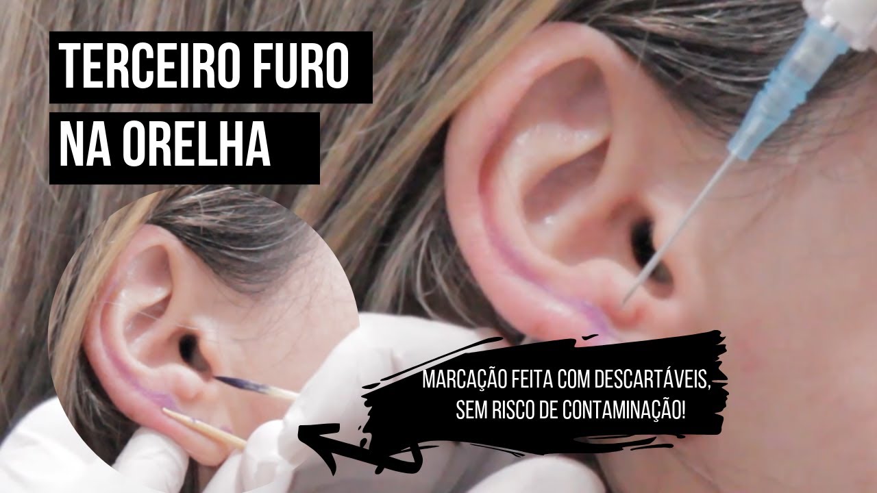 TERCEIRO FURO NA ORELHA