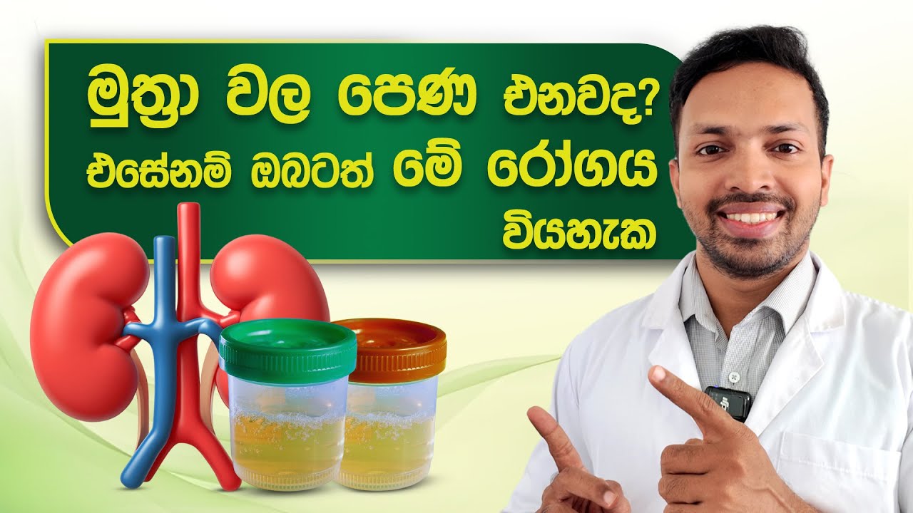 මුත්‍රා වල පෙණ එනවද? එහෙනම් ඔබටත් මේ රෝගය විය හැක | Proteinuria | Protein in urine