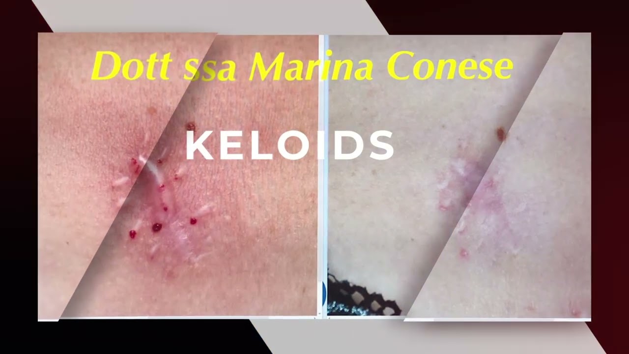 WHAT CAN BE TREATED WITH PLEXR PLASMA | Plexr Plus