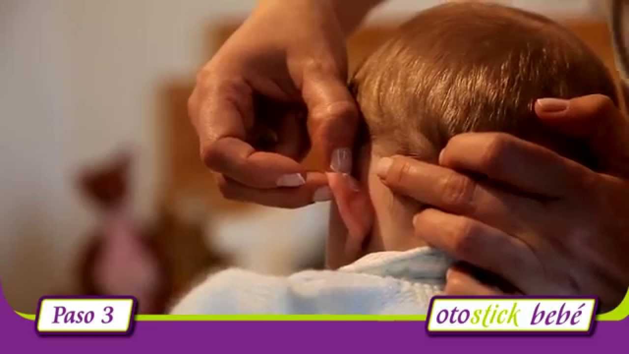 Método de colocación Otostick Bebé -corrector estético para orejas separadas-
