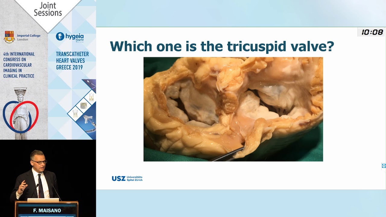F. Maisano | Patient selection for transcatheter tricuspid.