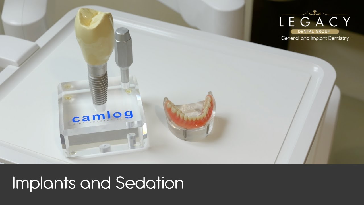 Everything You Need To Know About Dental Sedation and Implants