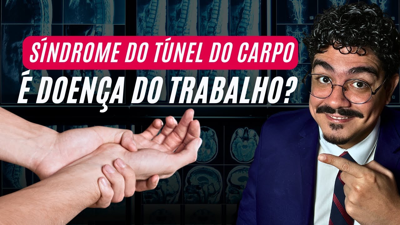 Síndrome do Túnel do Carpo é Doença do Trabalho?