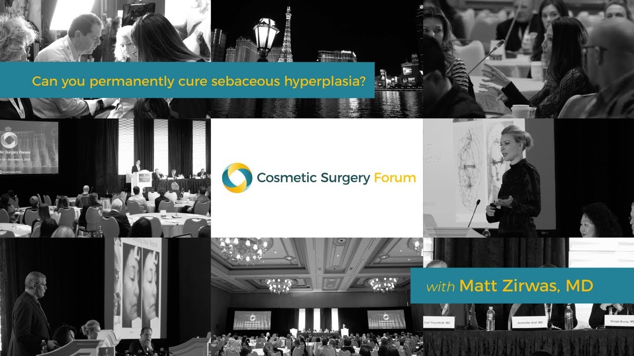 Can you permanently cure sebaceous hyperplasia with Matt Zirwas, MD