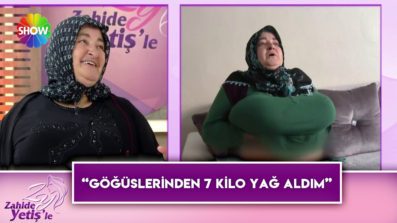Meme küçültme operasyonu geçiren Gülsen Yıldız, hastanede neler yaşadı?