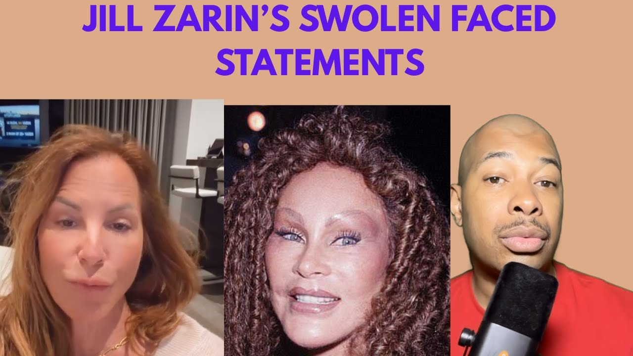 Jill Zarin’s Crows Feet Caw! & Tight Cheeks Cause Cancelation & E! Boycott Rumors