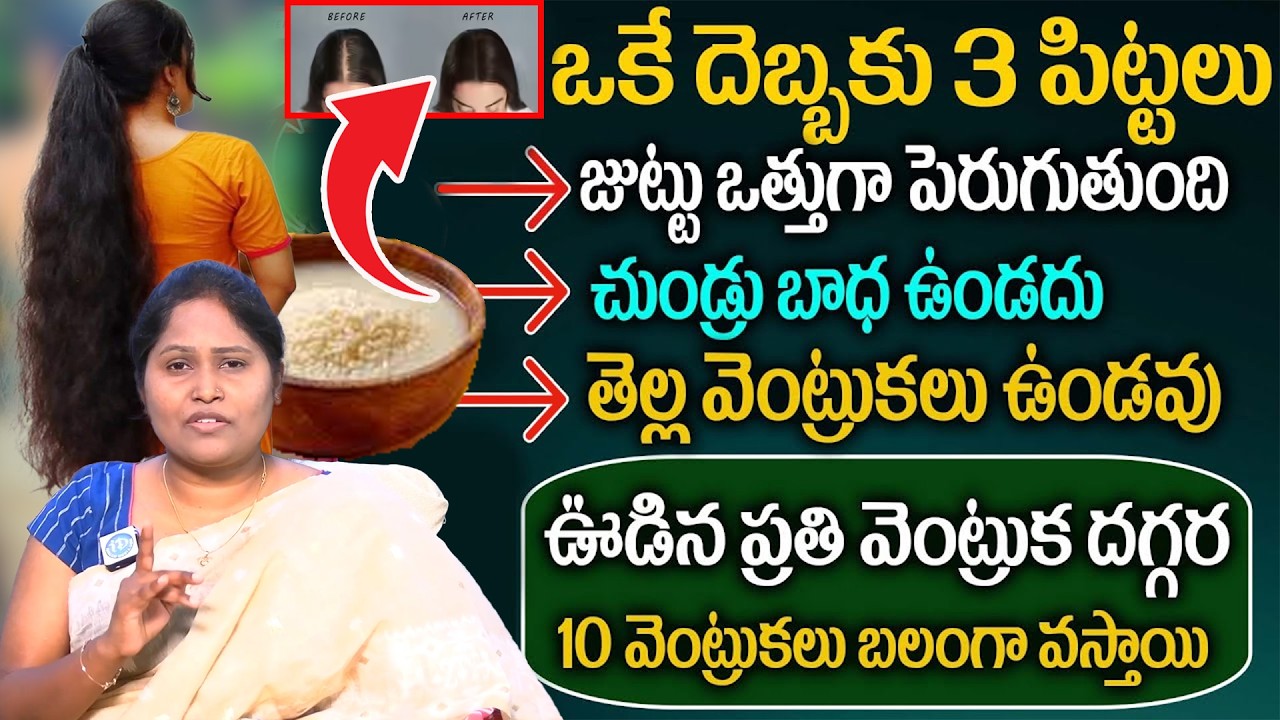 వద్దన్నా!! జుట్టు పెరిగిపోతుంది అసలు పట్టి పీకినా ఊడదు || Hair Fall Telugu ||  Dr. Shagufta