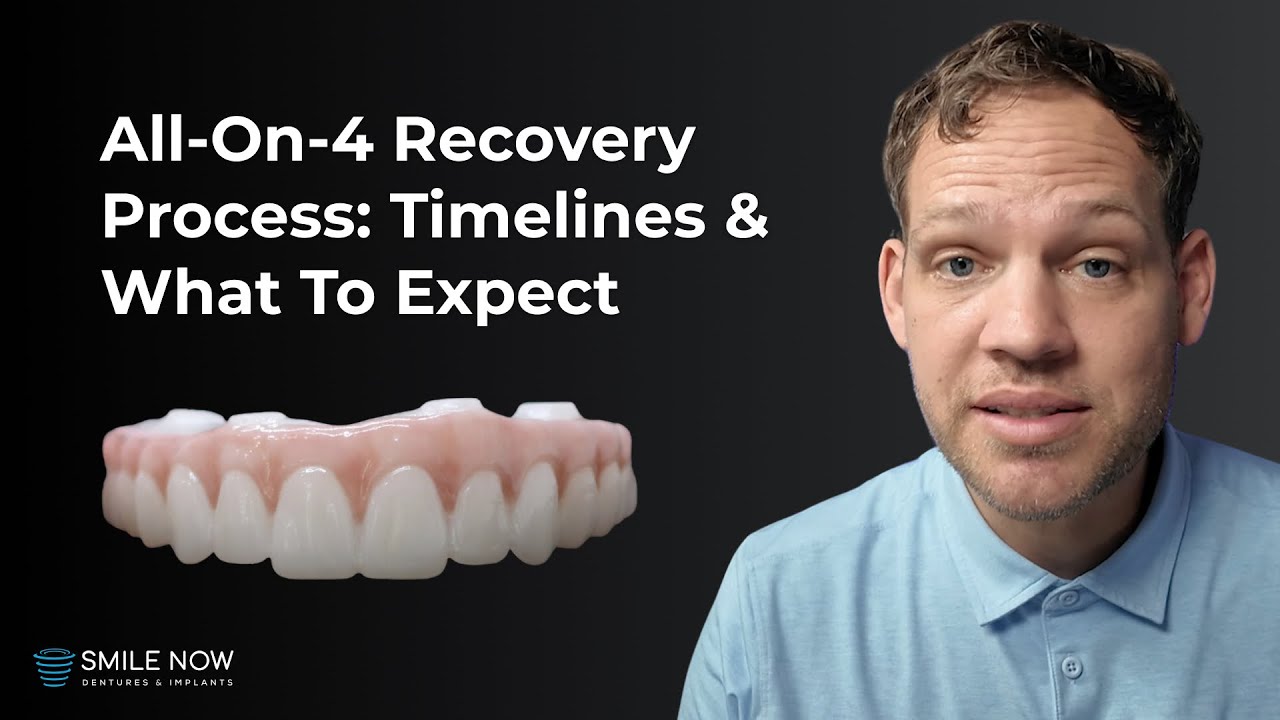 All On 4 Dental Implant Recovery Process: What to Expect