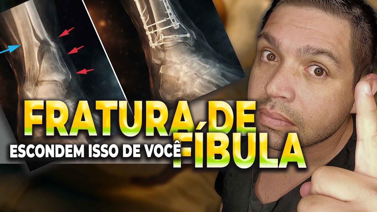 Você Está Fazendo o ERRO de NÃO Priorizar a Recuperação do Seu Tornozelo?
