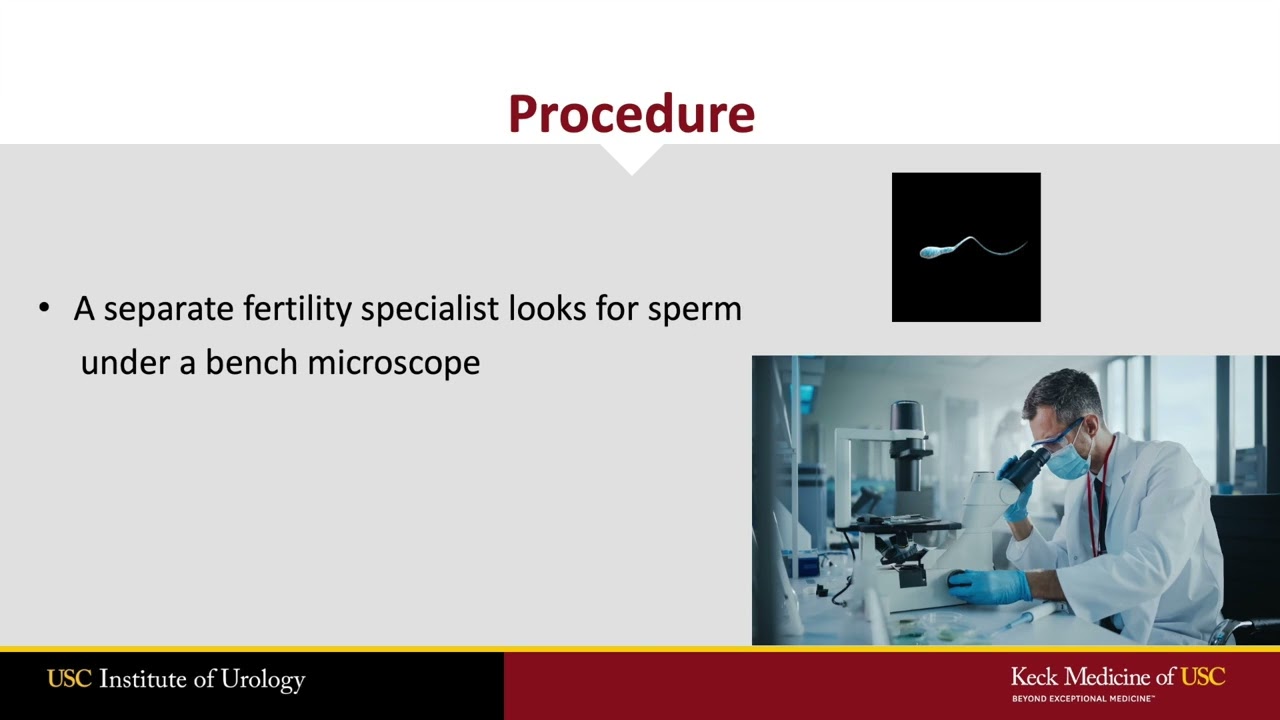 Testicular Sperm Extraction (TESE)- What Every Patient Needs to Know