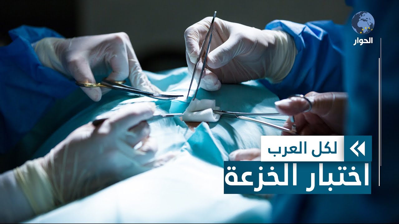 ما هي الخزعة؟ ومتى يلجأ إليها الطب؟