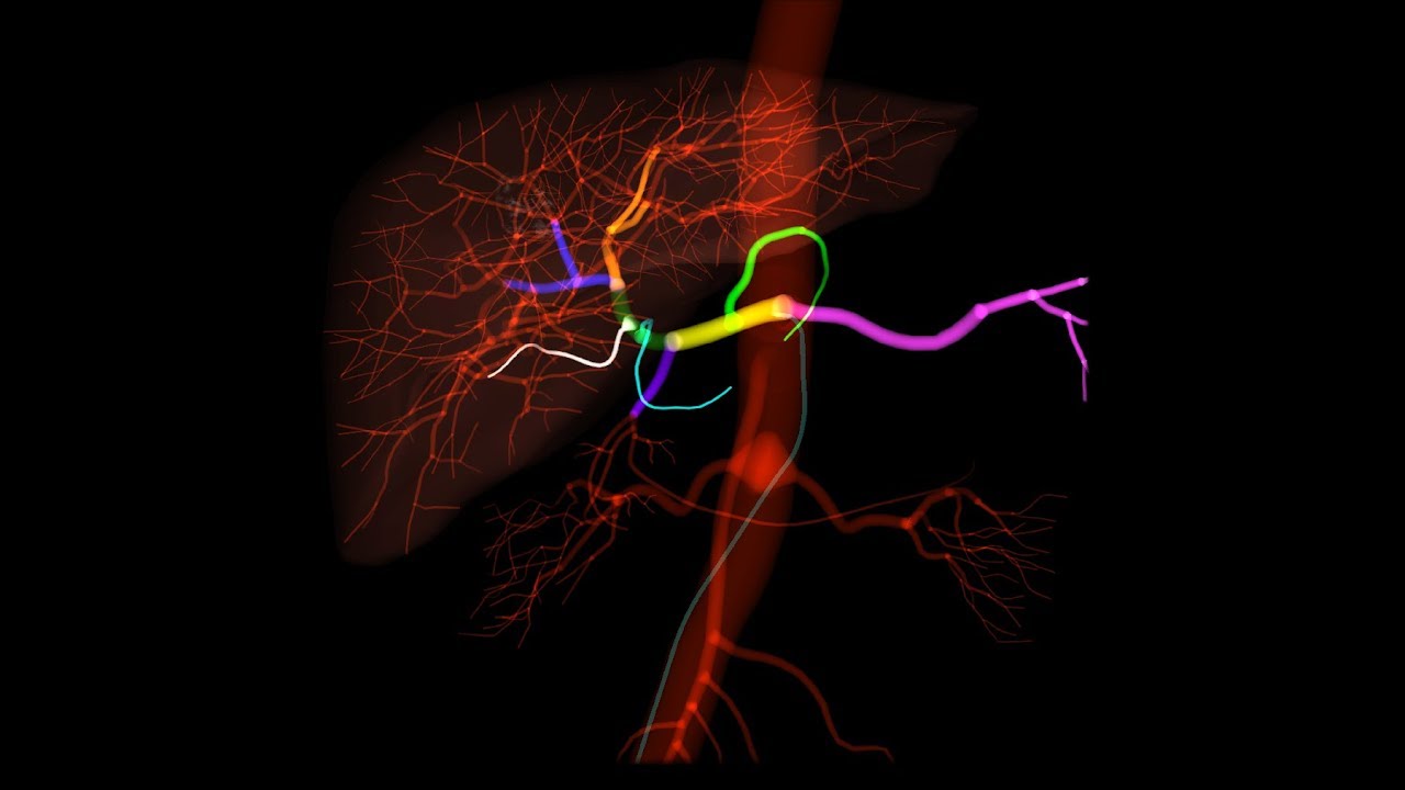 Mentice Transarterial Chemoembolization (TACE) Training Software