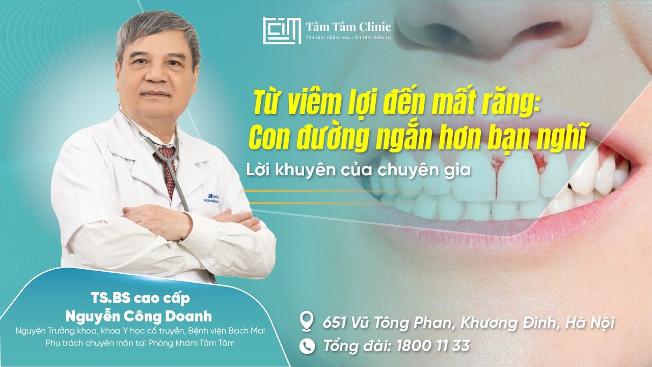 Viêm lợi: Có thể tàn phá răng âm thầm – Đừng đợi đến lúc quá muộn, xem ngay video