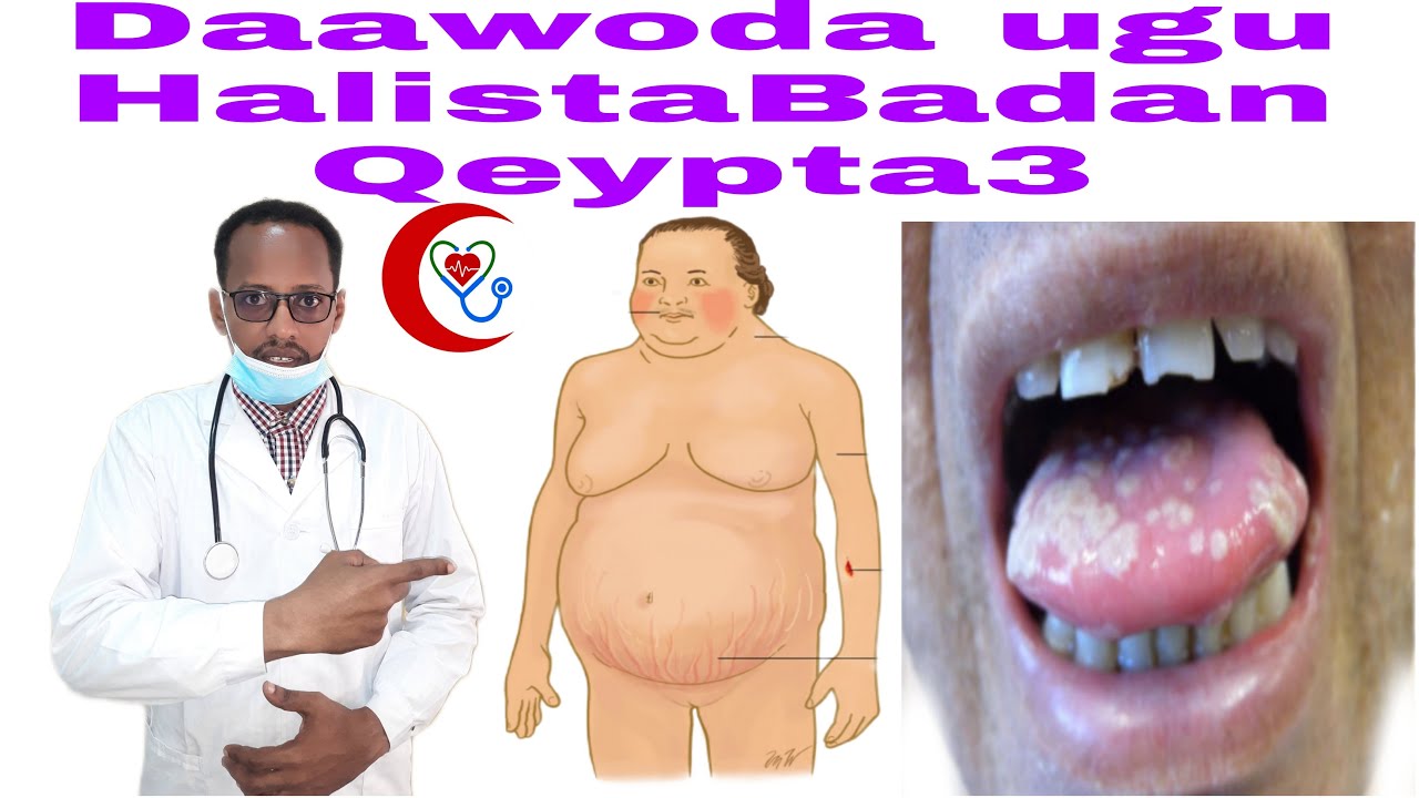 Daawoyinka ugu Halista Badan oo Bulshada Si Joobto u Isticmaasho iyo Dhibaatooyinka Ka Dhasha .