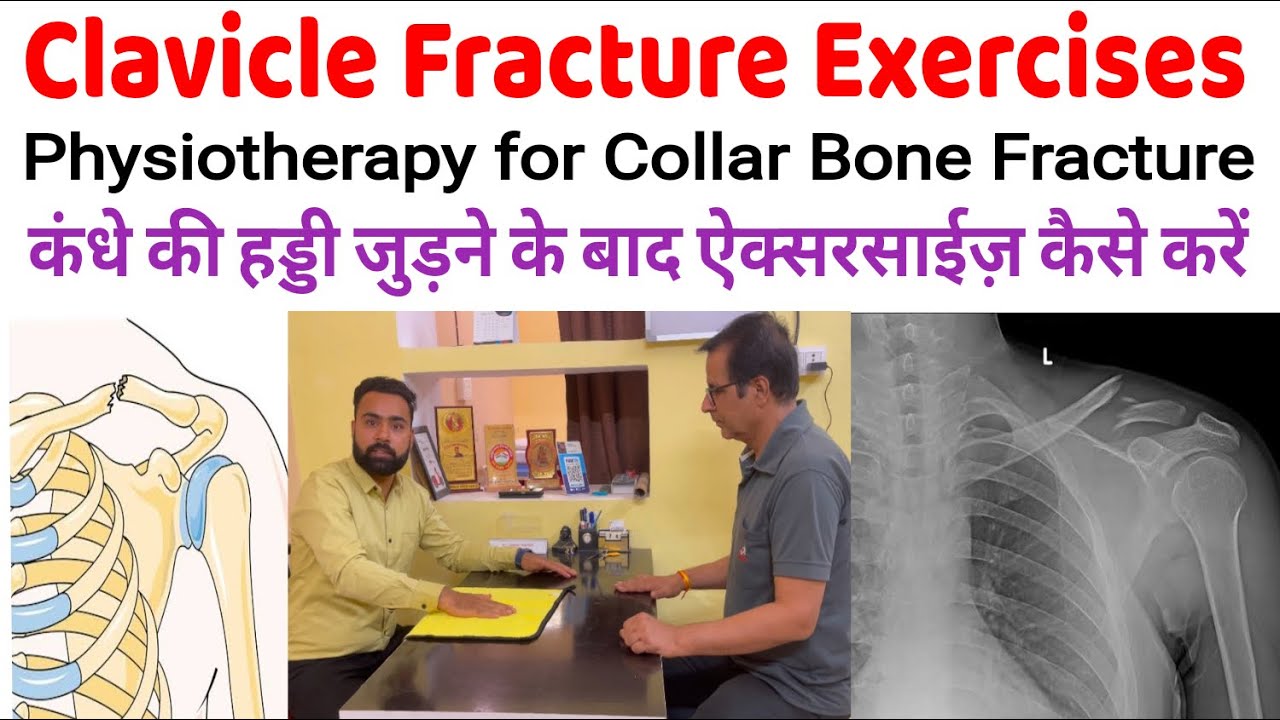 Physiotherapy for Clavicle Bone Fracture (Collar Bone Fracture) | Shoulder Fracture Rehab Exercises