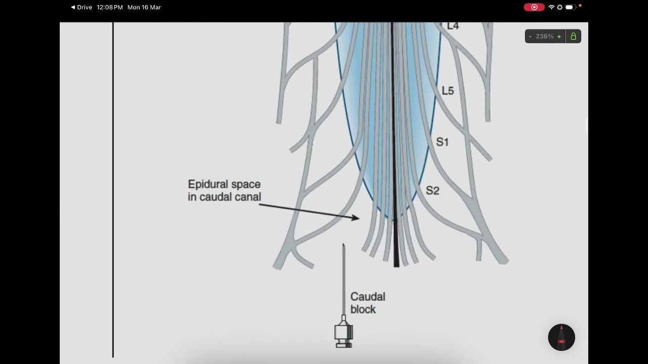 NS | Pharmacology L9+10+11