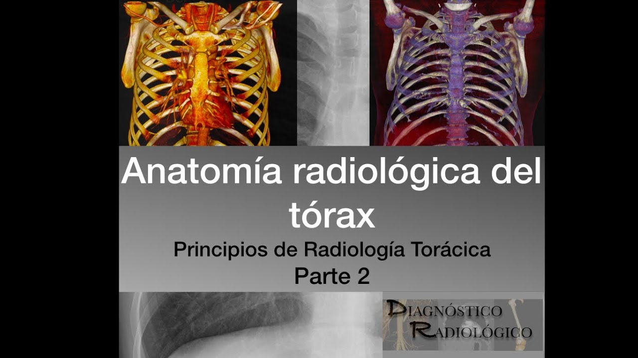 Aprende la anatomía radiológica del tórax. Principios de Radiología torácica Parte 2