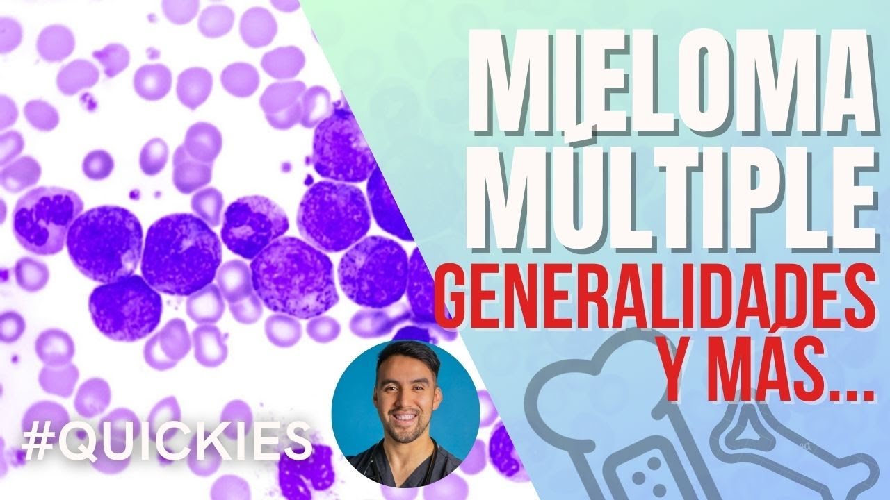 Mieloma Múltiple: Síntomas, diagnóstico, tratamiento y cómo afecta a quienes lo padecen.
