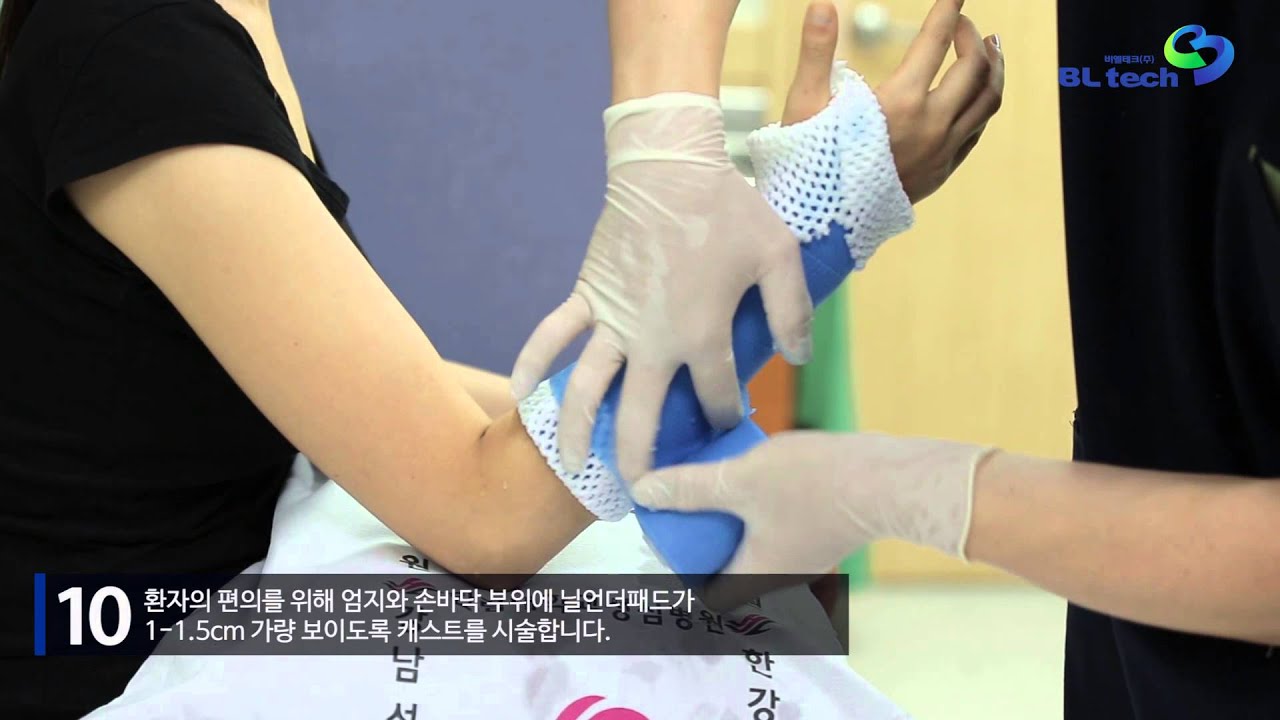 닐 캐스트 short arm 시술