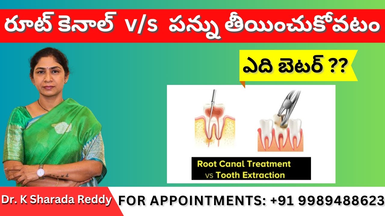 రూట్ కెనాల్ vs పన్ను తీయించుకోవటం ఎది బెటర్ ?? Root canal vs Tooth Removal | by Dr. K Sharada Reddy