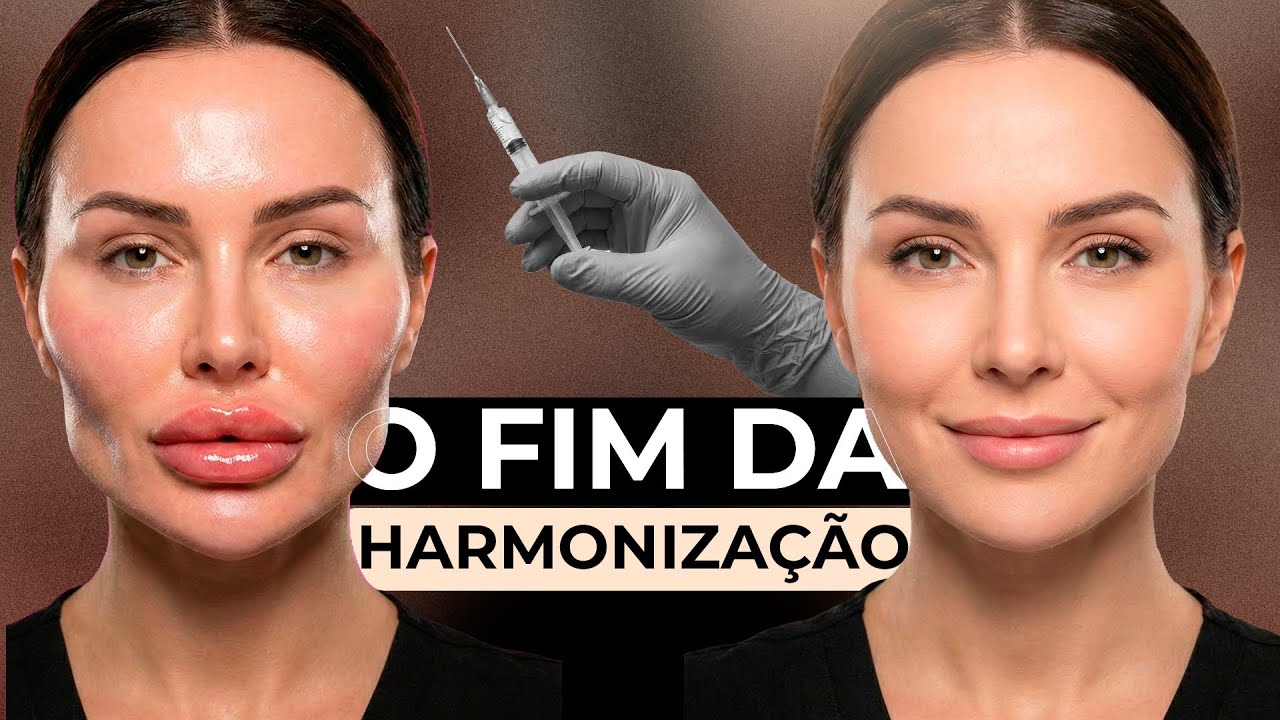 o FIM da era da HARMONIZAÇÃO FACIAL? Em busca do Lifting Deep Plane | DR. RICARDO KACOWICZ
