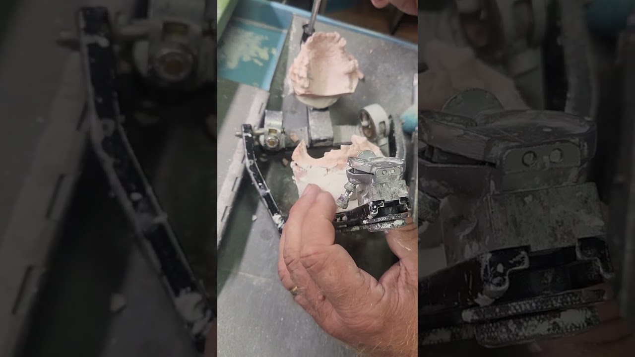 trim the teeth on the model for an overdentutre