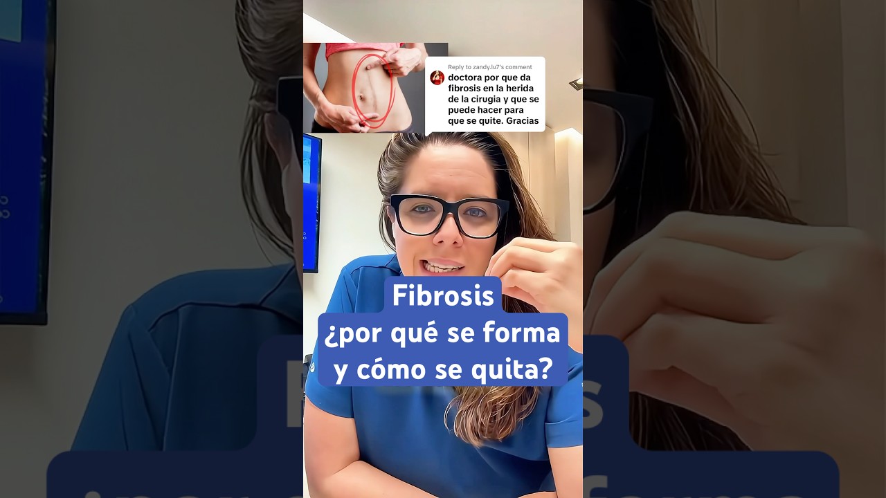 Fibrosis en las heridas👩🏼&zwj;⚕️#doctora #fibrosis #cirugiageneral #herida #salud