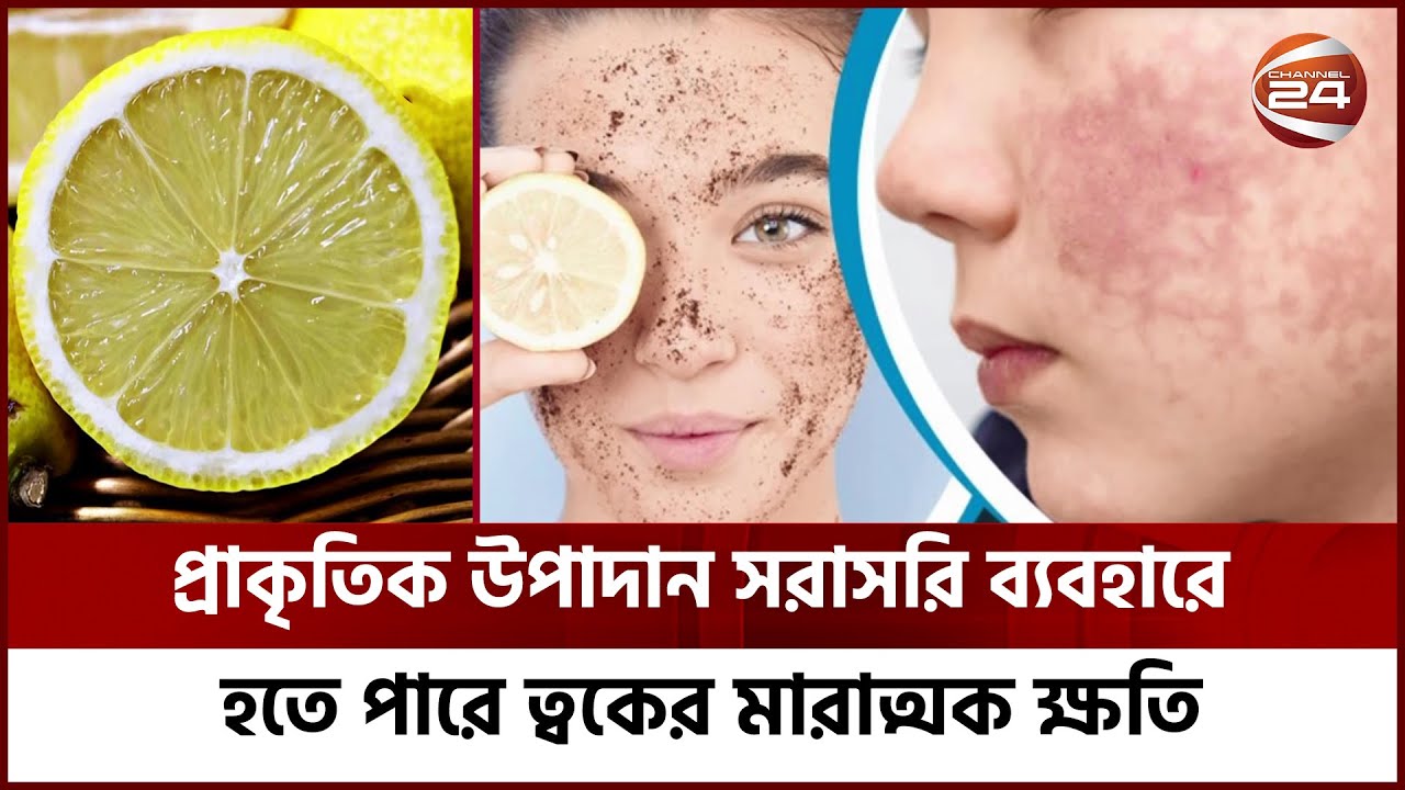 প্রাকৃতিক উপাদান সরাসরি ব্যবহারে হতে পারে ত্বকের মারাত্মক ক্ষতি | Channel 24
