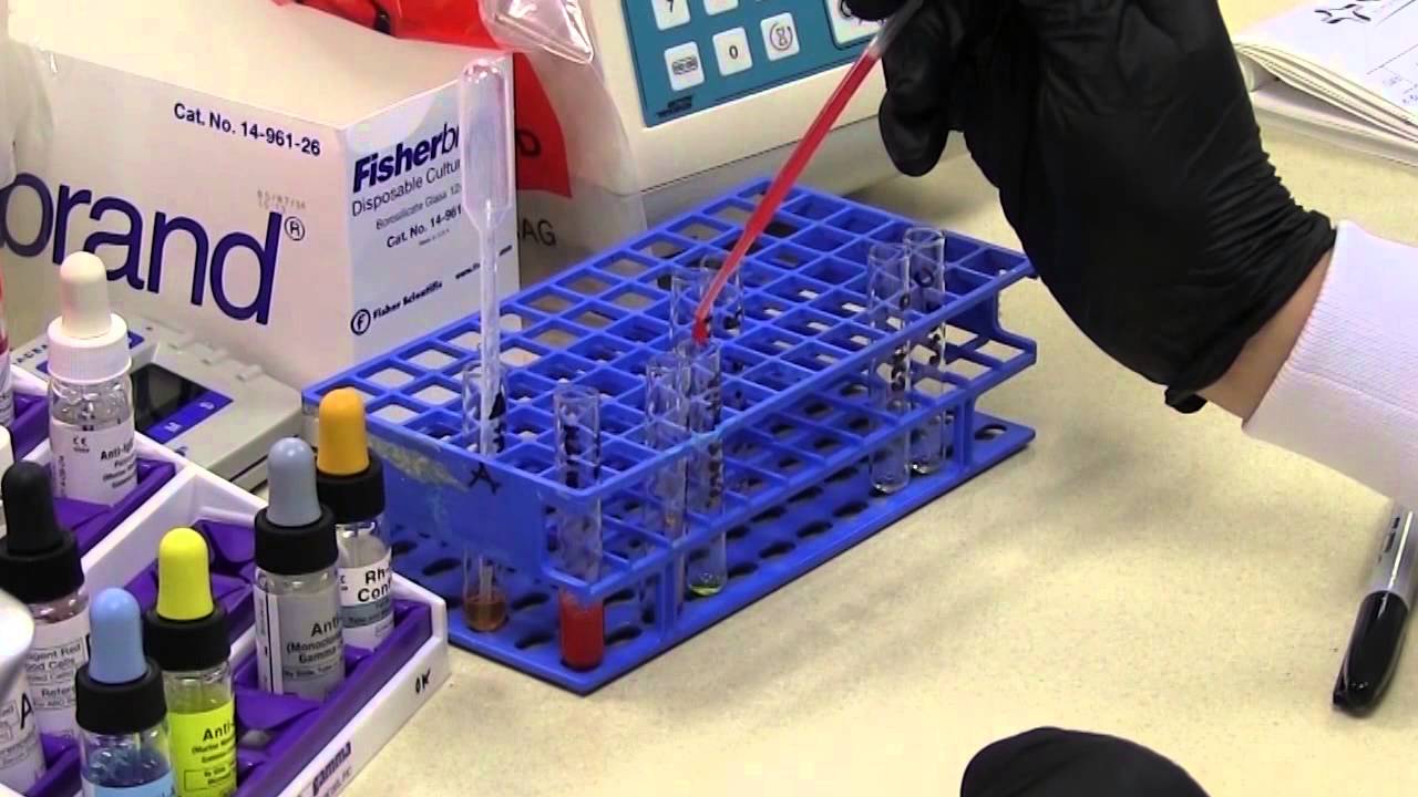 Blood Bank - ABO Rh