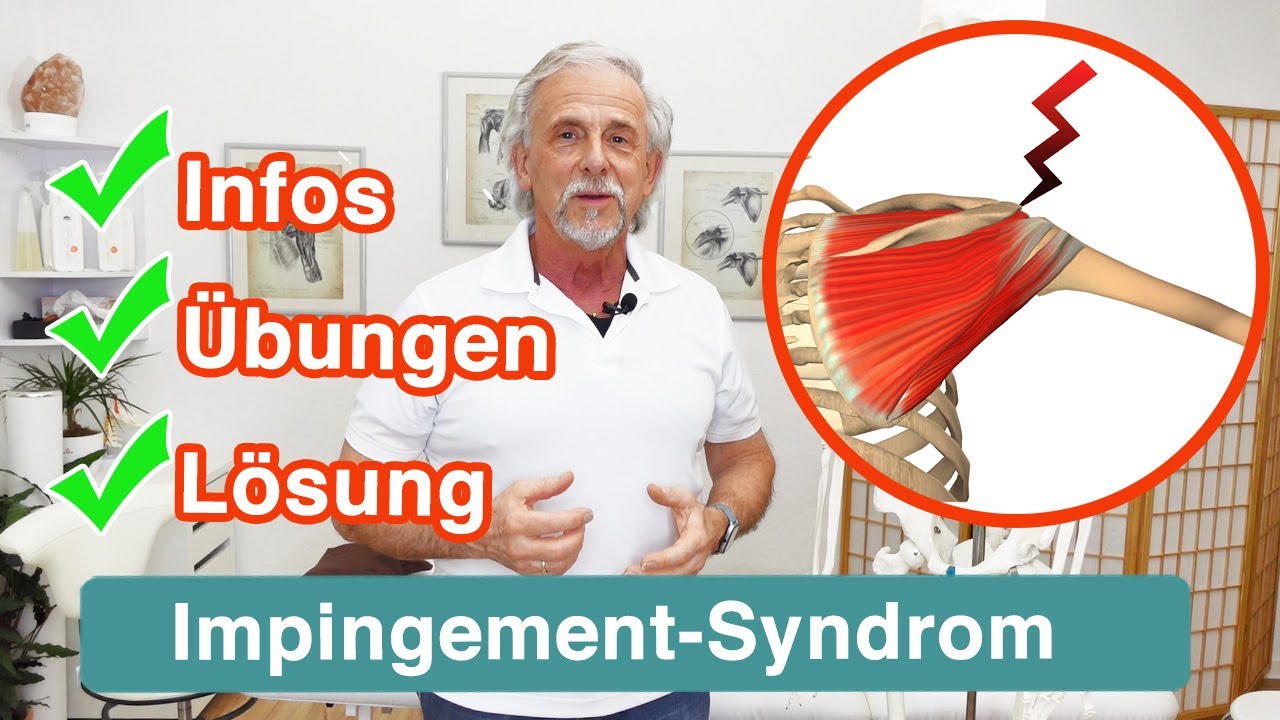 Impingement Syndrom ✅ Erklärungen | Übungen und Lösung für deine Schulter