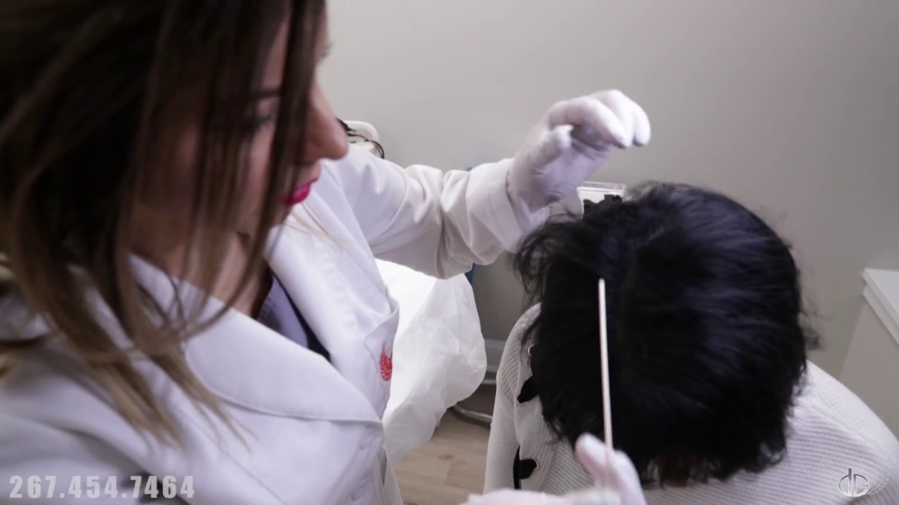 Woman beats hair loss with Scalp Micropigmentation!