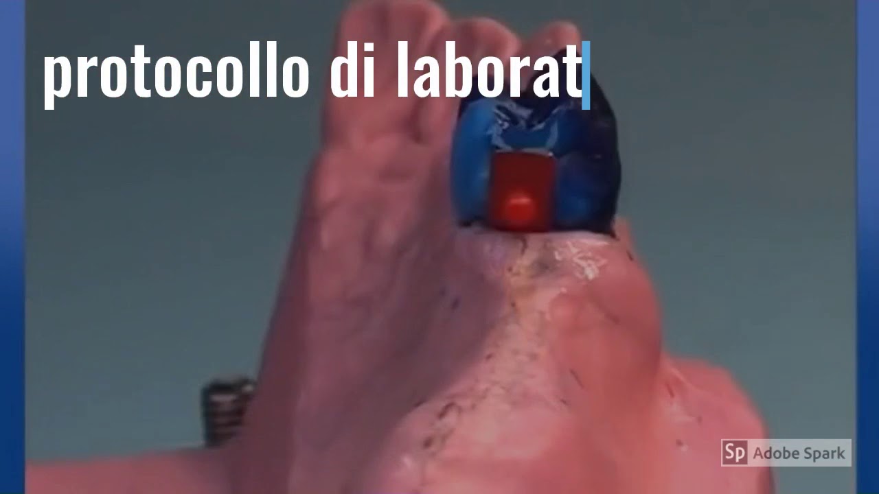 Videolezione protesi combinata prof. Ciccone