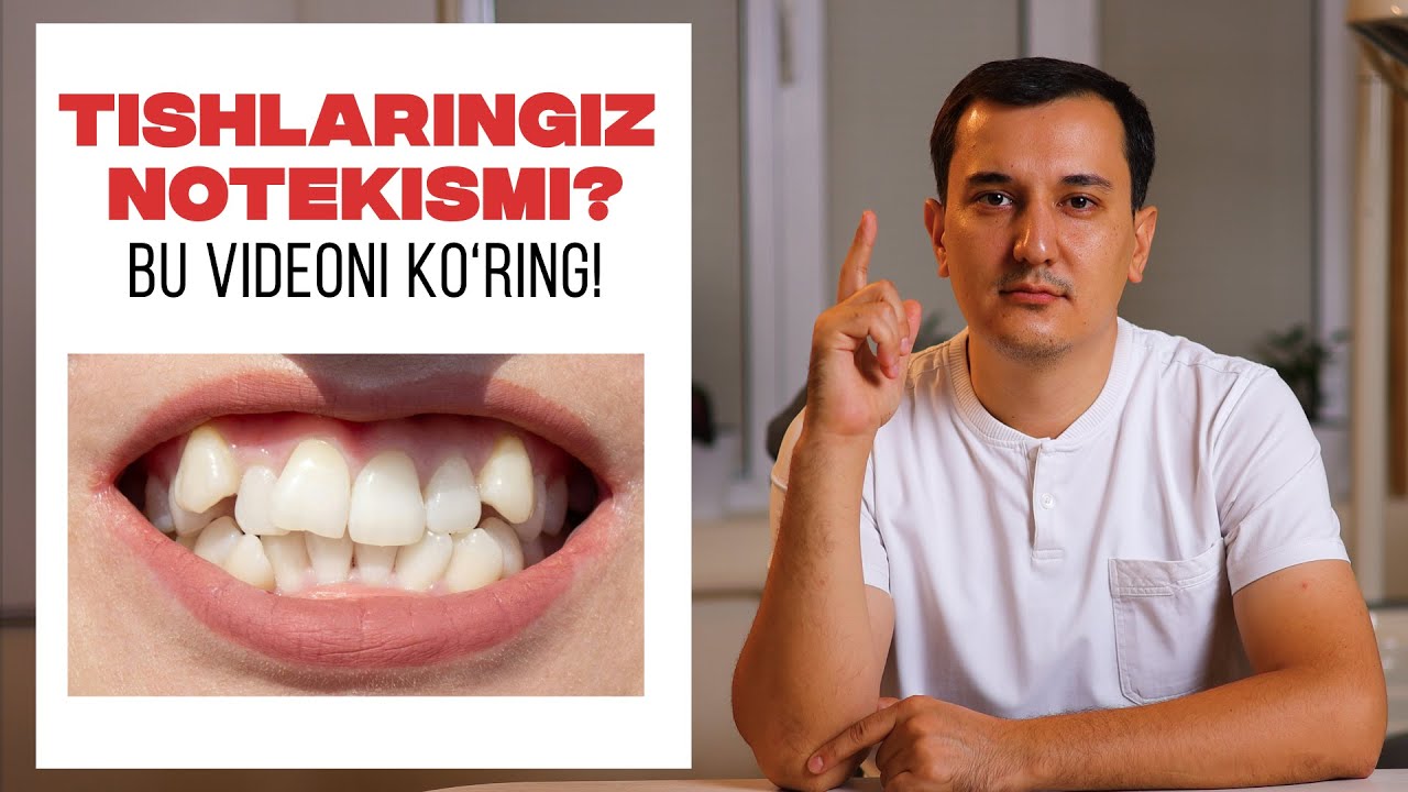 Tishlaringiz notekismi? Bu videoni ko‘ring | Keys tahlili