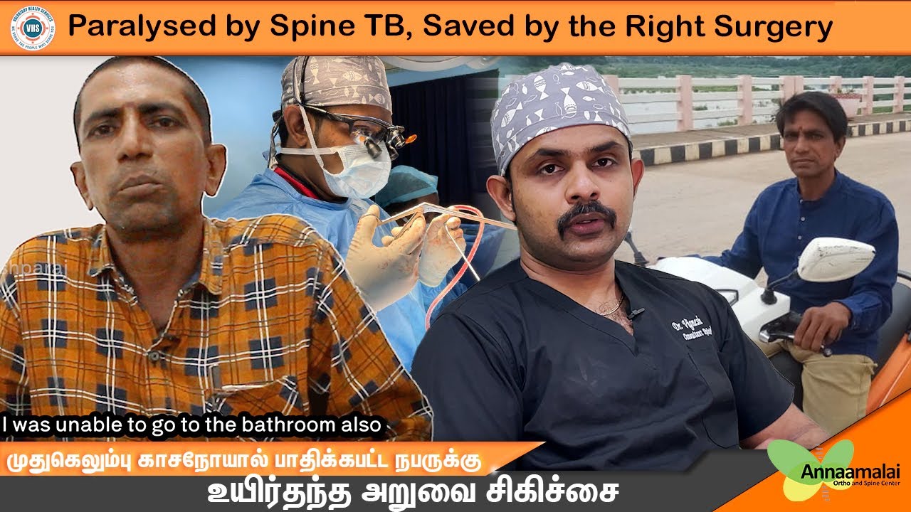 Paralyzed by Spine TB, saved by the Right Surgery Dr. Vignesh Pushparaj