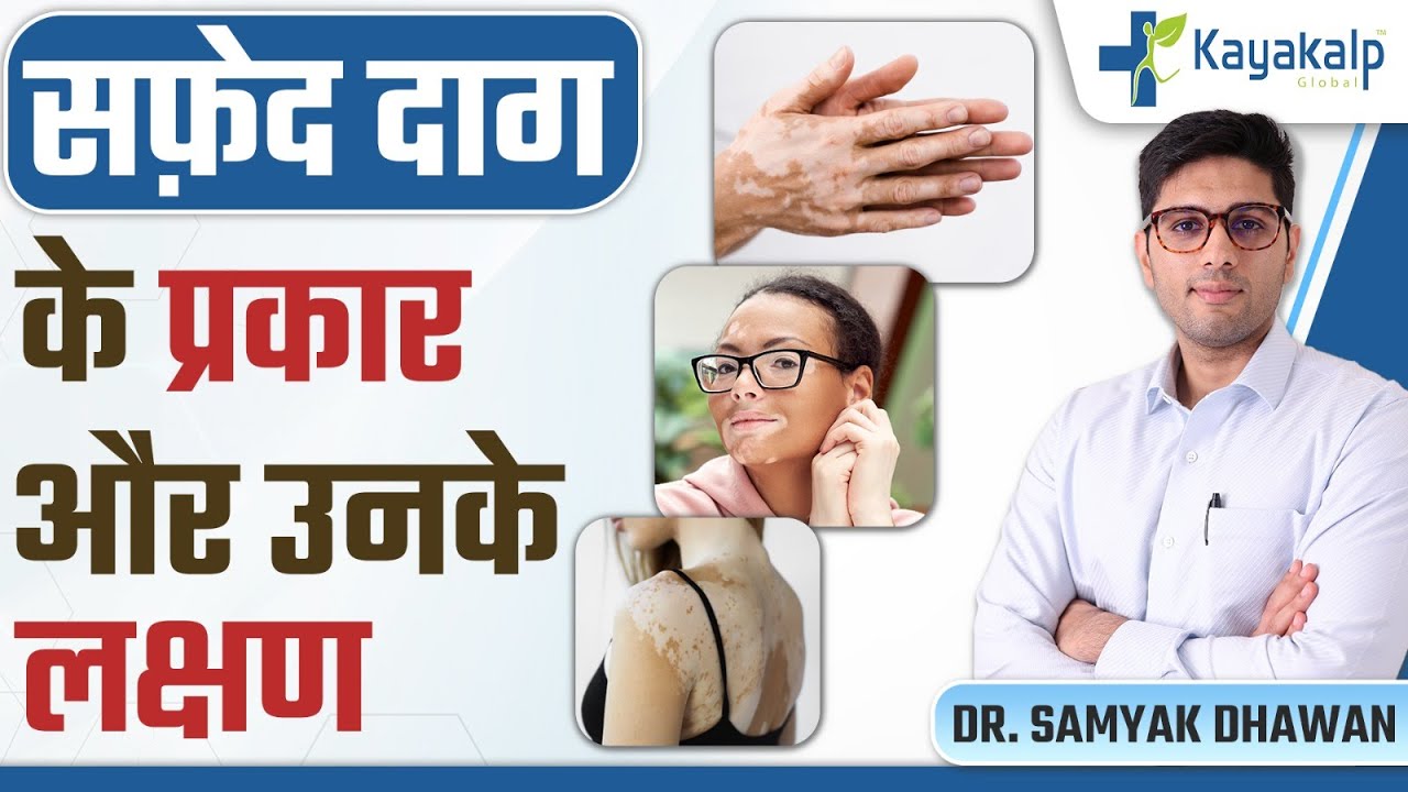 सफेद दाग कितने प्रकार के होते हैं और उनके लक्षण | Types of Vitiligo and Symptoms | Kayakalp Global